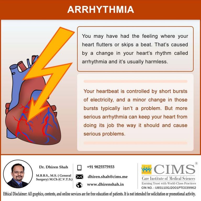 arrhythmia-the-best-cardiac-surgeon-in-ahmedabad-and-best-heart